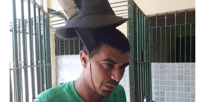 মাথায় গাঁথা চাপাতি, তবুও হাঁটছে যুবক