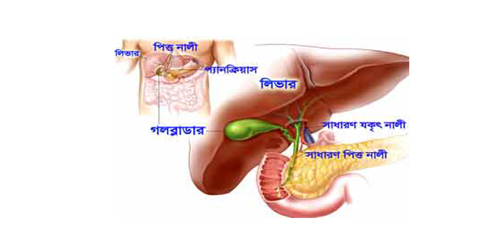 পিত্তথলিতে পাথরের চিকিৎসায় হোমিওপ্যাথি