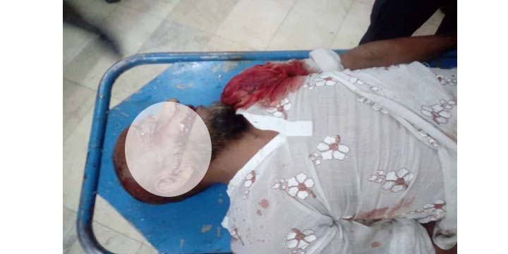 সদর দক্ষিণের ‘বন্ধুকযুদ্ধে’ মাদক ব্যবসায়ি নুরু নিহত