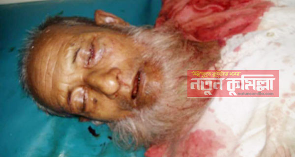 চৌদ্দগ্রামে ডাক্তার দেখাতে এসে গাড়ি চাপায় নিহত এক