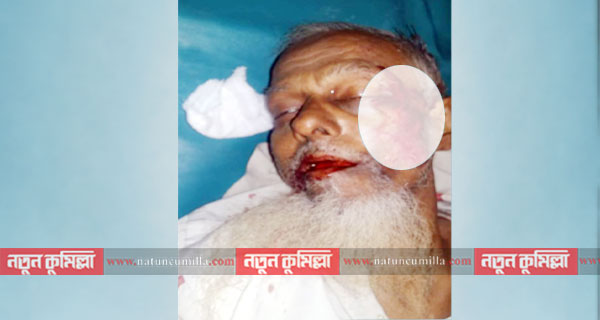 চৌদ্দগ্রামে গাড়ির ধাক্কায় বৃদ্ধার মৃত্যু