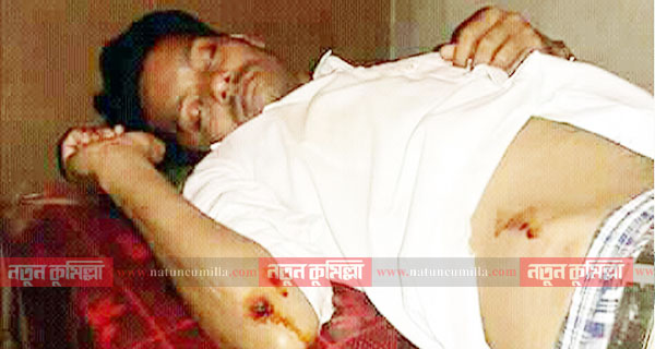কুমিল্লায় সাংবাদিককে ছুরিকাঘাত করে ছিনতাই