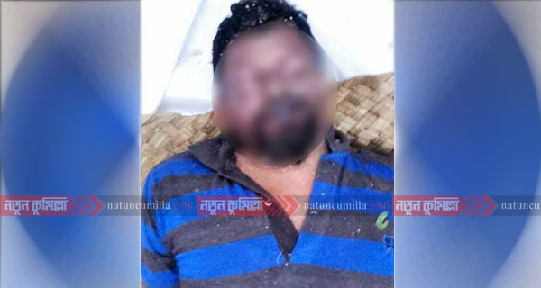 কুমিল্লায় ২ মাসেও মেলেনি লাশের পরিচয়, সন্ধান চাই পুলিশ