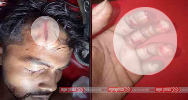 কুমিল্লা মহানগরীর উনাইসারে ডাকাতিকরে স্বর্নালংকারসহ মালামাল লুট