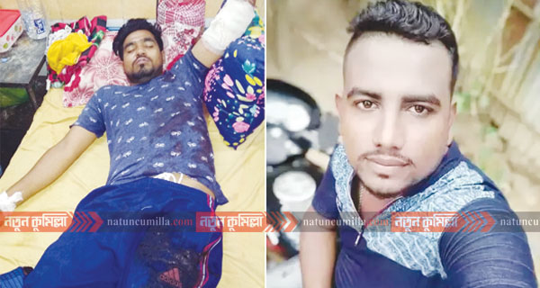 সদর দক্ষিণে প্রবাসী যুবককে ডেকে নিয়ে কুপিয়ে হত্যার চেষ্টা