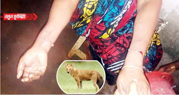 কুমিল্লার হোমনায় শিয়ালের কাঁমড়ে ২ নারী গুরুতর আহত