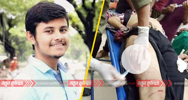 ভিক্টোরিয়া কলেজ ক্যাম্পাসে ঢুকে ছাত্রকে কোপানোর অভিযোগ