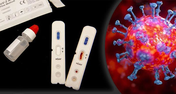 কুমিল্লায় নতুন ৮ জনের করোনা সনাক্ত, আক্রান্ত বেড়ে ৯২